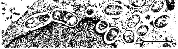 Researchers warn about Brucella risk from unpasteurized, raw milk