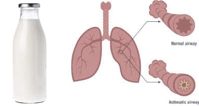 Role of milk and dairy products in asthma