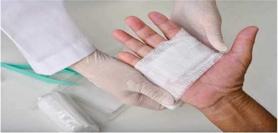 Casein – A Protein found in milk speeds up wound healing