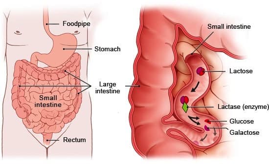 A Fresh History of Lactose Intolerance