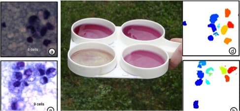 Somatic cell count limit may curb antibiotic residue in milk