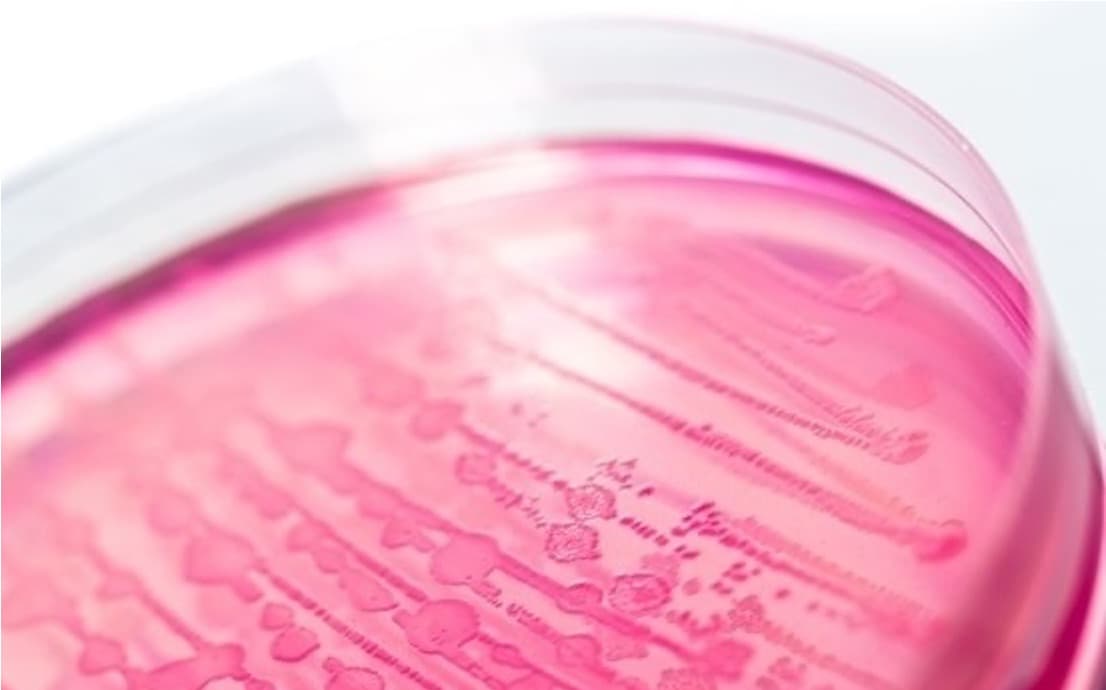 Widespread E. coli contamination found in Egyptian dairy