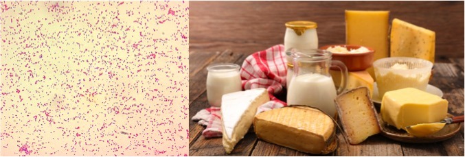 Study shows Brucella problem for raw dairy products in Tunisia - Dairy News 7X7